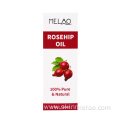 Organic Rosehip Seed Body Essential Oil